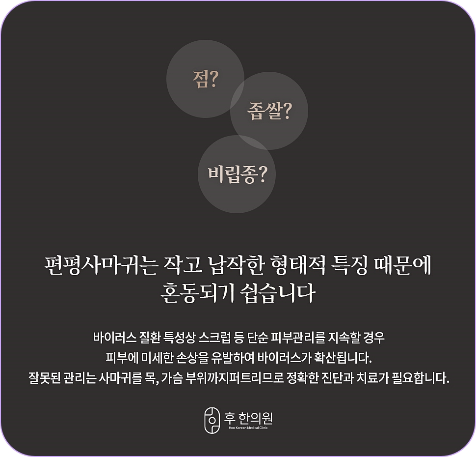 노원편평사마귀레이저 쥐젖 좁쌀 비립종 관련 분별 이미지
