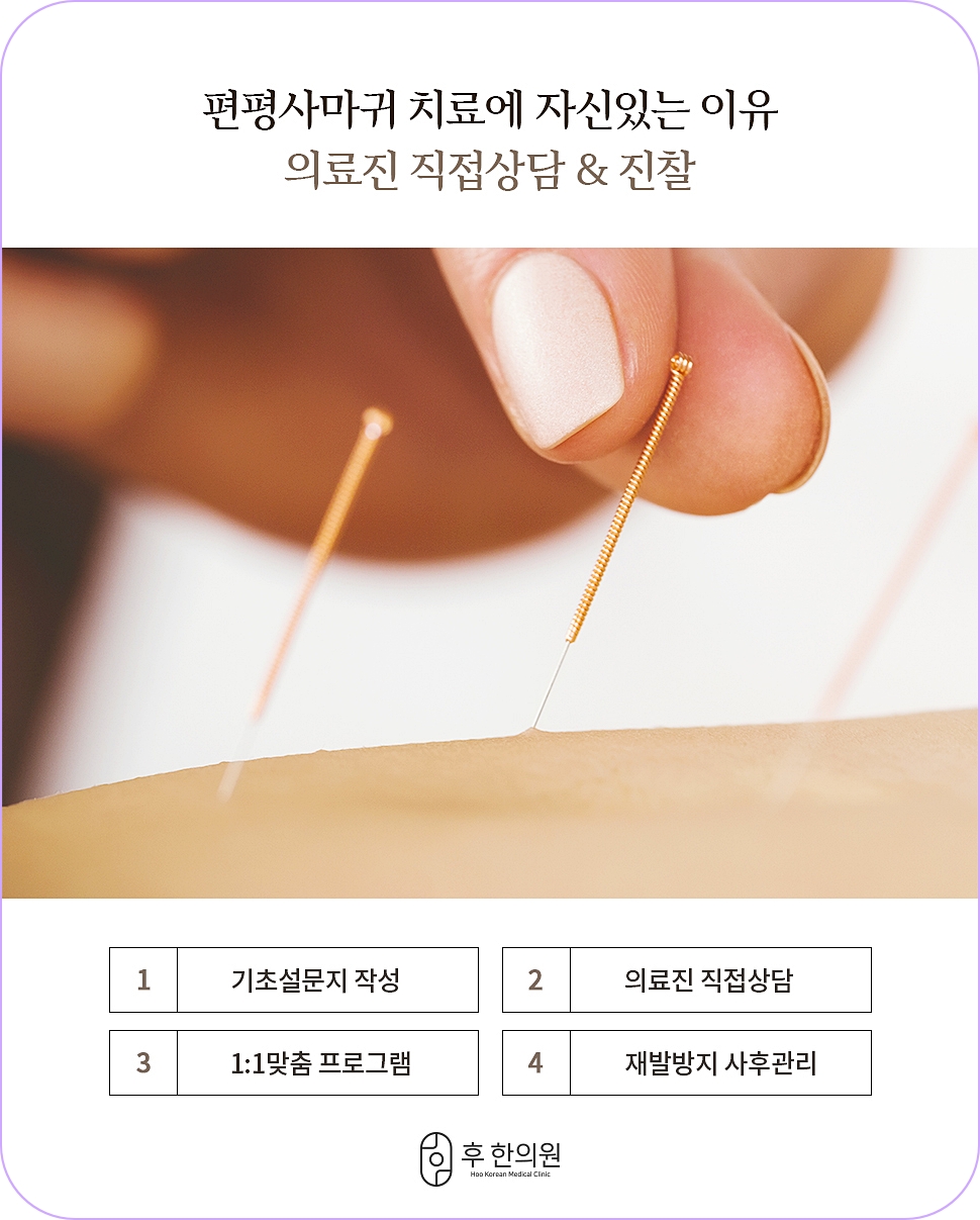 노원편평사마귀레이저 치료 과정 전반에 대한 설명