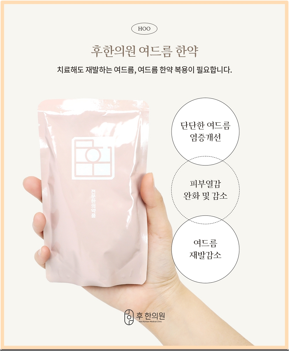 후한의원 노원점의 여드름 한약 효과 정리