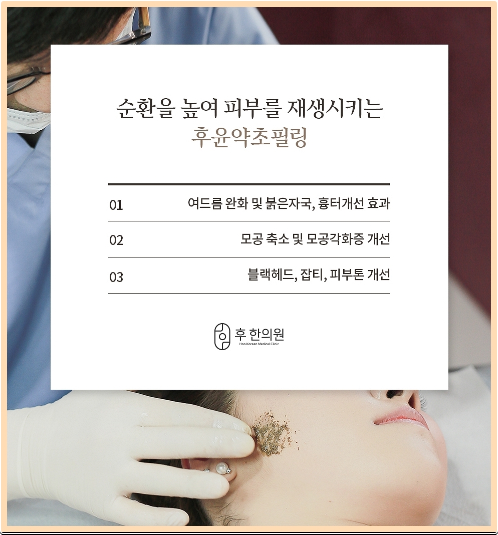 노원여드름피부과 약초필링 방법에 대한 내용