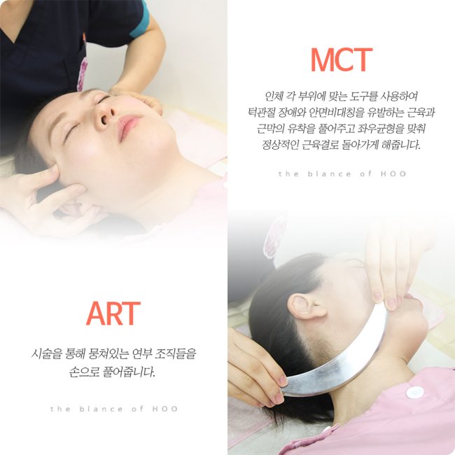노원안면비대칭한의원 치료법2