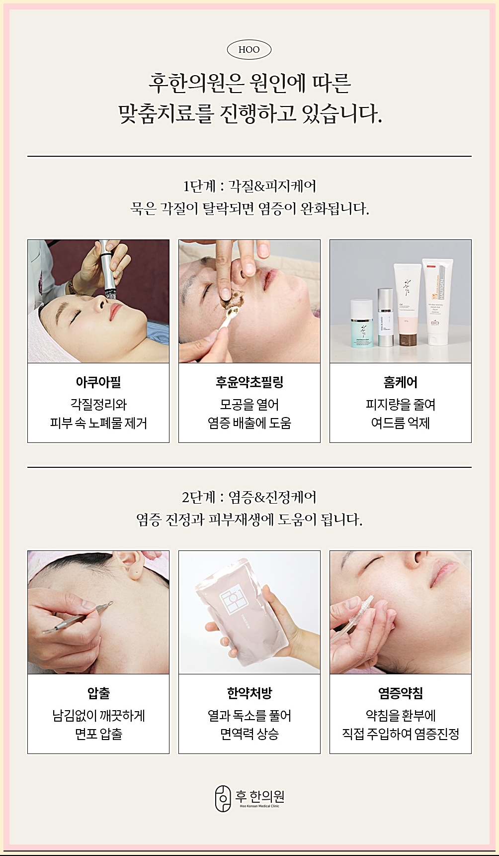 의정부여드름 후한의원의 여드름 치료 과정