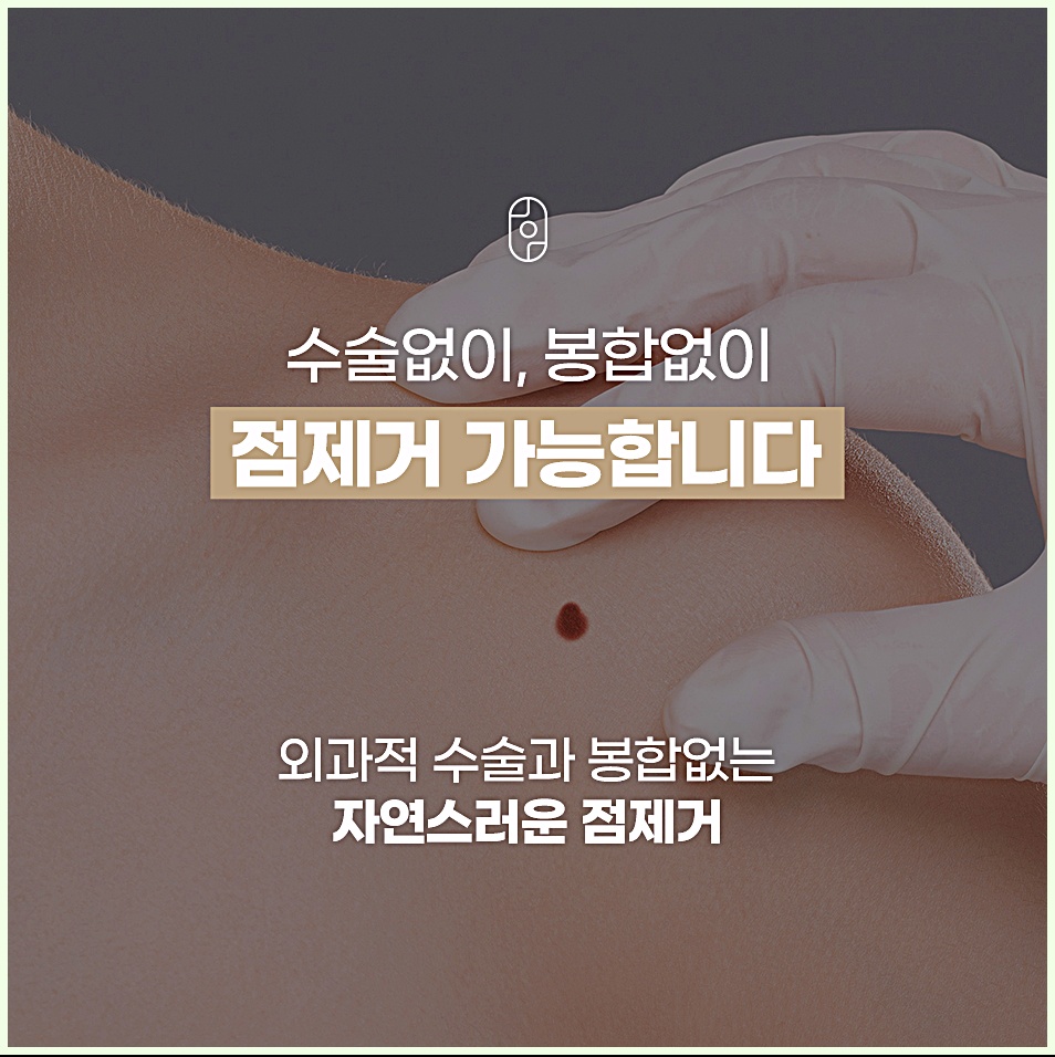 수술없이 봉합없이 가능한 자연스러운 점제거 설명