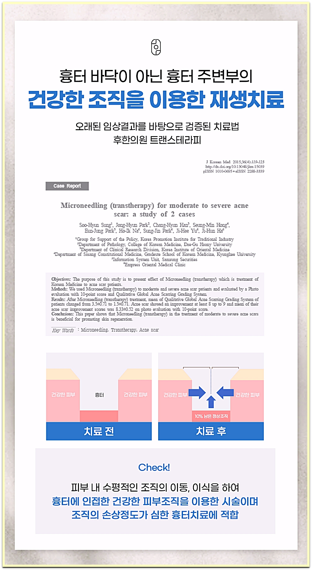 트랜스테라피(새살침) 흉터 주변 건강한 피부조직 활용 재생치료 설명