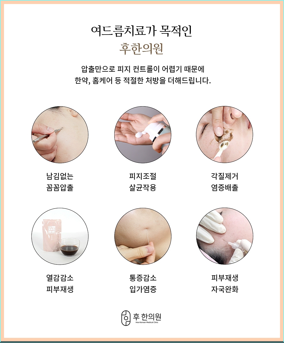 노원역피부과 후한의원 여드름 치료 과정