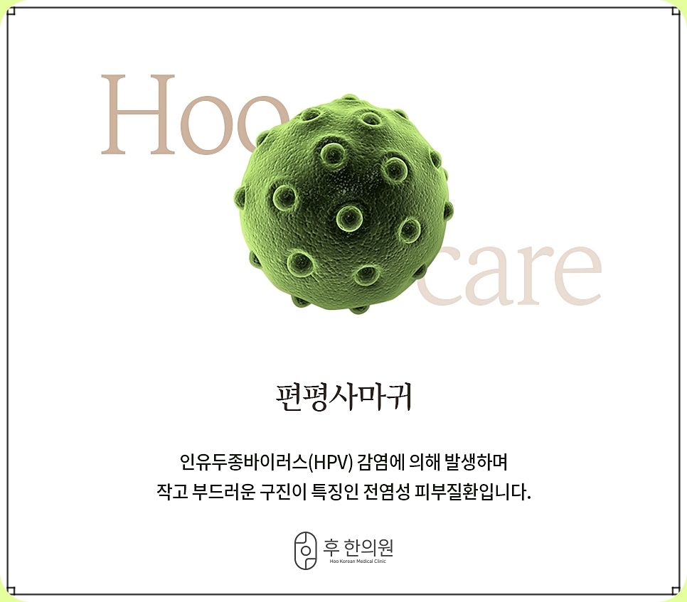 노원편평사마귀제거 편사의 정의