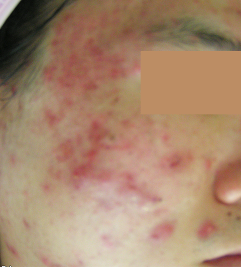 Before
