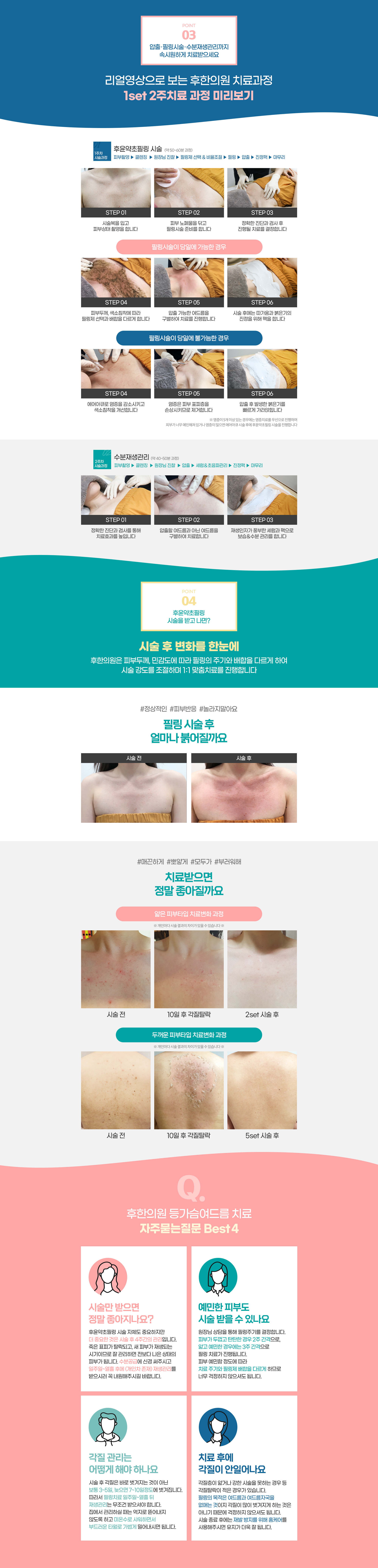 랜딩이미지